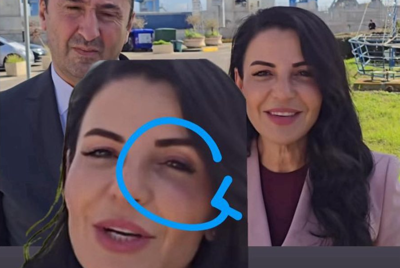 Syri i nxirë! Zbulohet e vërteta e madhe, ja çfarë i ka ndodhur Belinda Ballukut që merakosi të gjithë