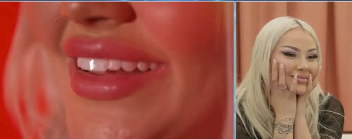 Benita zbulon kush ia pagoi dhëmbët 18 mijë euro